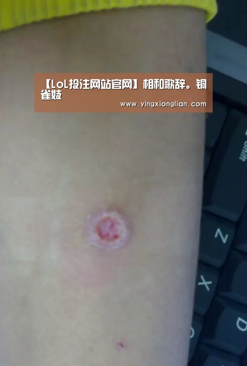 LoL投注网站直播